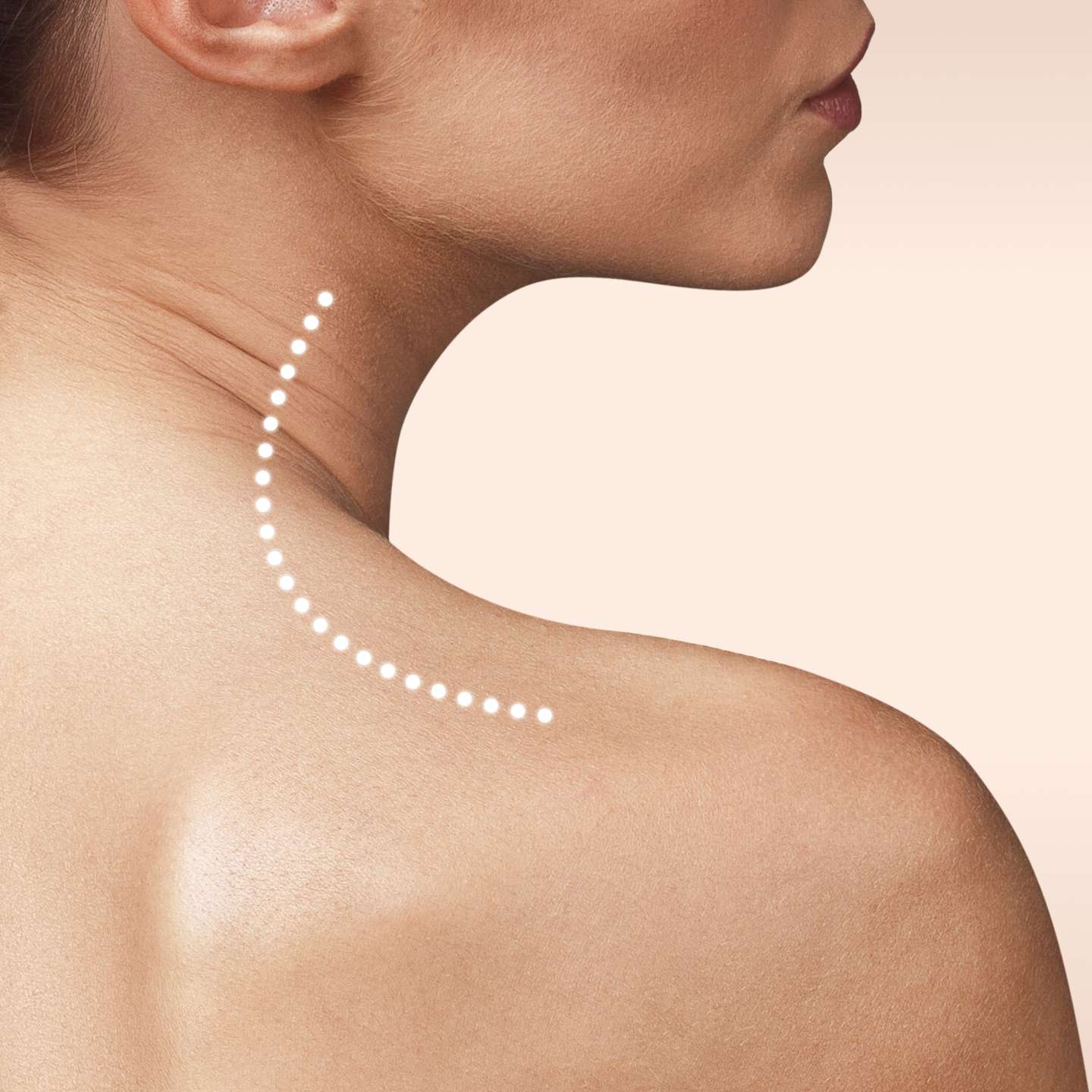 Bild eines Modells barbie glow Behandlung glowtox