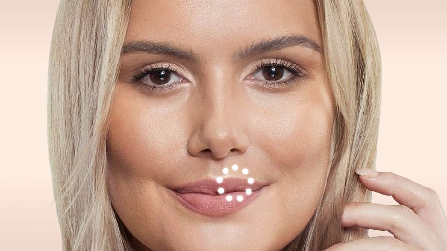 Bild eines Modells Lip Flip Behandlung glowtox