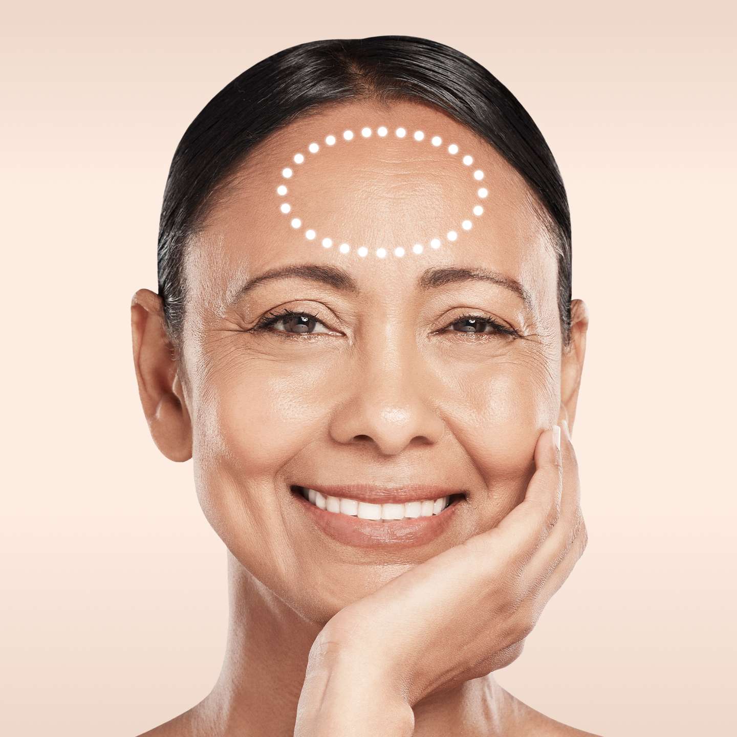 Bild eines Modells Stirnfalten Behandlung glowtox