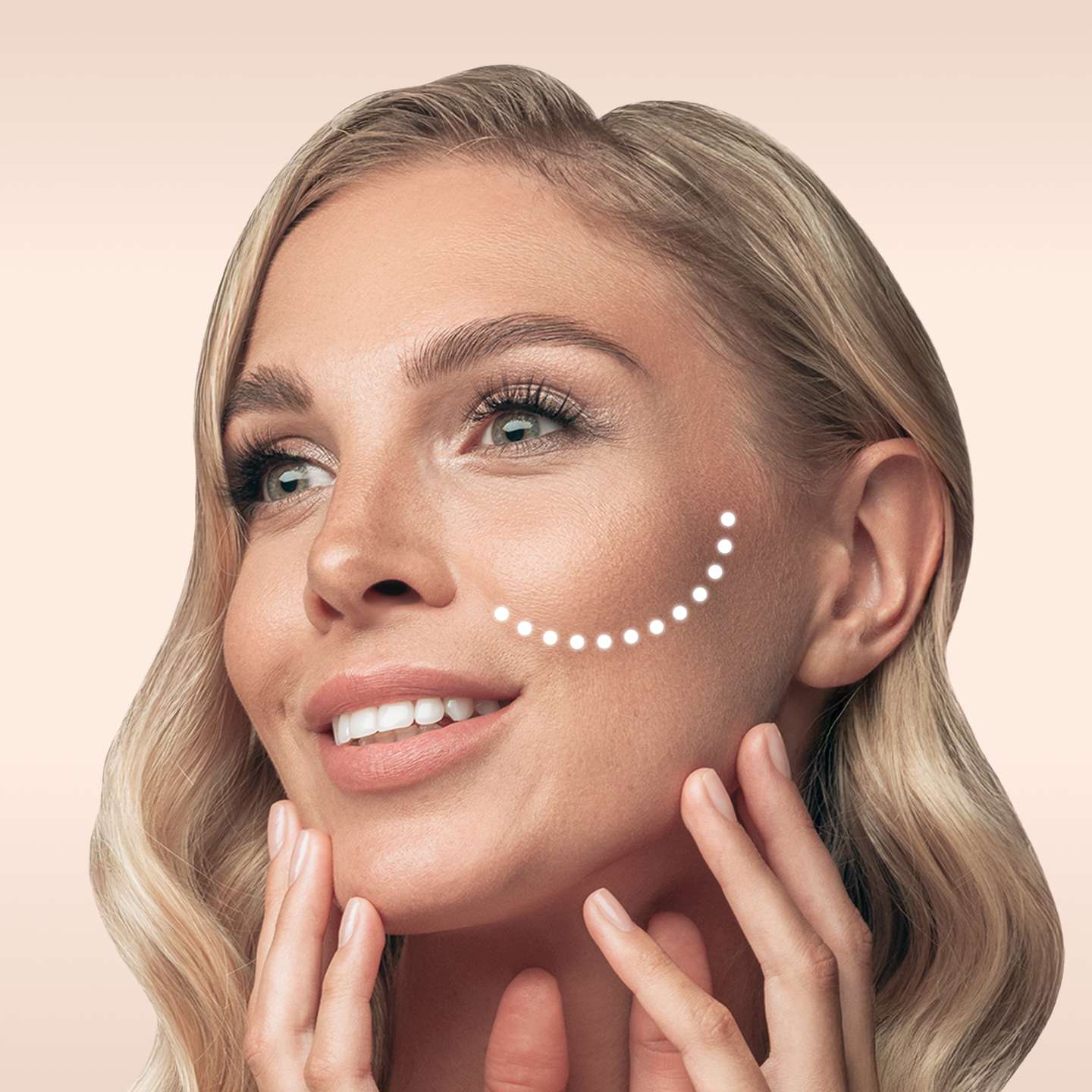 Bild eines Modells Wangenaufbau Behandlung glowtox